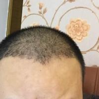 <font color="red">稀少加密</font>用戶圖片