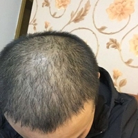 <font color="red">稀少加密</font>用戶圖片