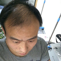 <font color="red">稀少加密</font>用戶圖片