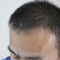 <font color="red">稀少加密</font>用戶圖片