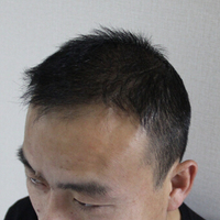 <font color="red">稀少加密</font>用戶圖片