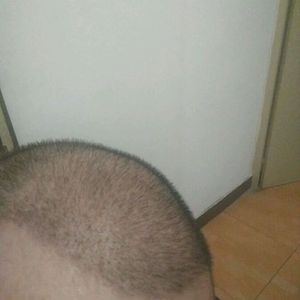 发际线分享社区