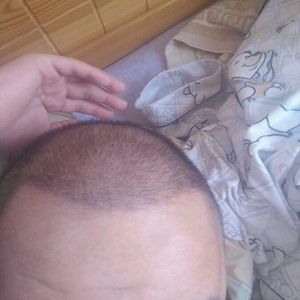 发际线分享社区