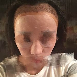 发际线分享社区