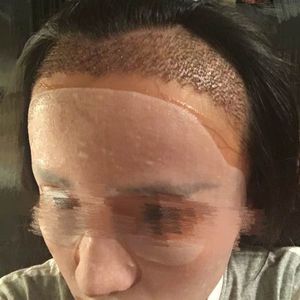 发际线分享社区