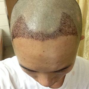 发际线分享社区