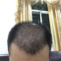 <font color="red">稀少加密</font>用戶圖片