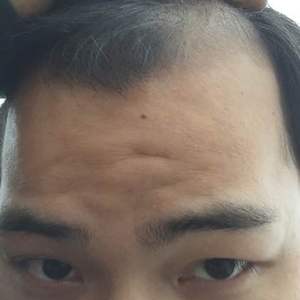 发际线分享社区