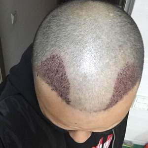 发际线分享社区