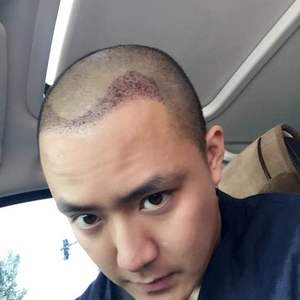 发际线分享社区