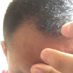 发际线分享社区