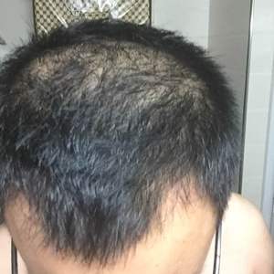 发际线分享社区