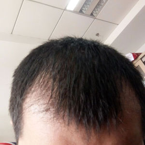 发际线分享社区