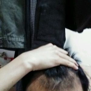 发际线分享社区