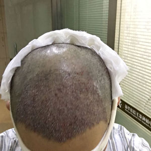 稀少加密分享社区
