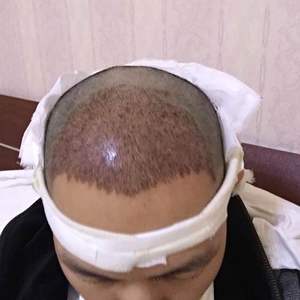 稀少加密分享社区