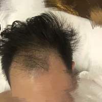 <font color="red">稀少加密</font>用戶圖片