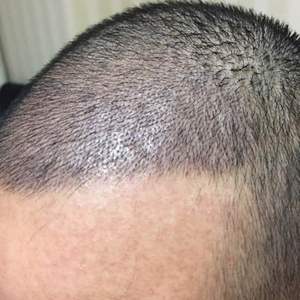 发际线分享社区