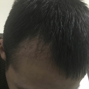 发际线分享社区