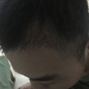 发际线分享社区