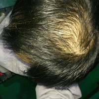 <font color="red">稀少加密</font>用戶圖片