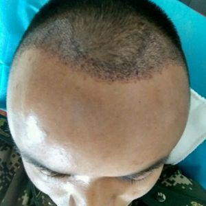 发际线分享社区