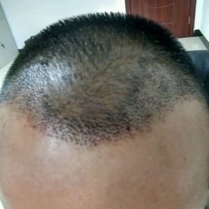 发际线分享社区
