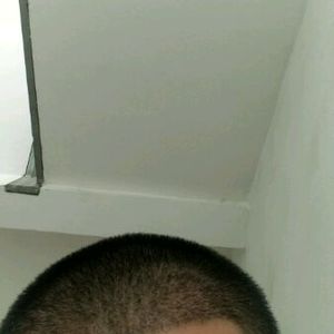 发际线分享社区