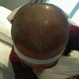 发际线分享社区