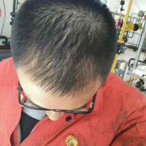 发际线分享社区