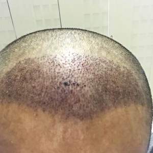 发际线分享社区