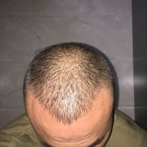 稀少加密分享社区