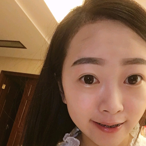 发际线分享社区