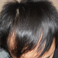 <font color="red">稀少加密</font>用戶圖片