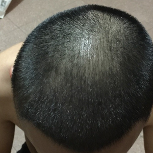 发际线分享社区