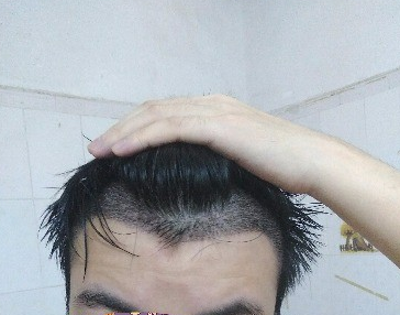 发际线分享社区