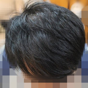 发际线分享社区