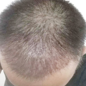 发际线分享社区