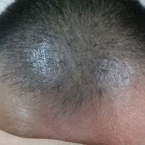 发际线分享社区