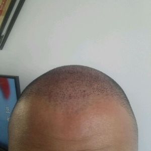 发际线分享社区