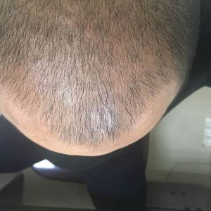 发际线分享社区