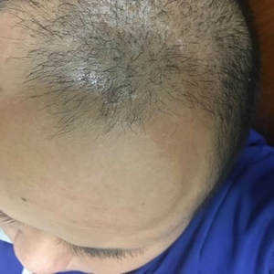 发际线分享社区