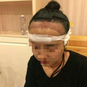 发际线分享社区