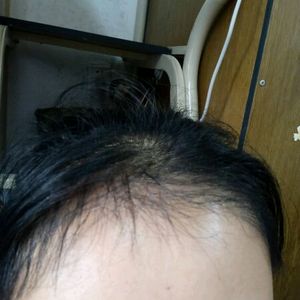 发际线分享社区