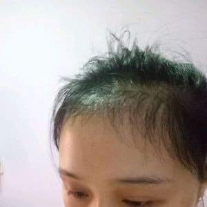 发际线分享社区