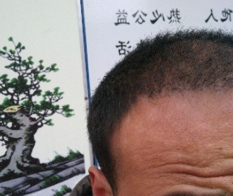 发际线分享社区