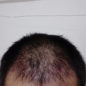 发际线分享社区