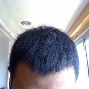 发际线分享社区