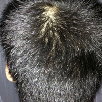 <font color="red">稀少加密</font>用戶圖片