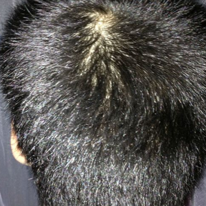 稀少加密分享社区